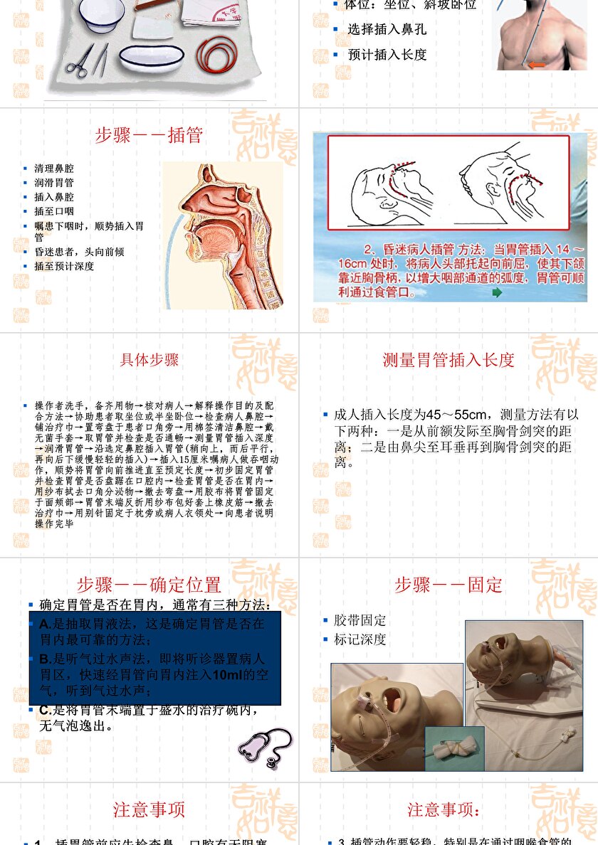 胃管最新固定方法詳解PPT展示